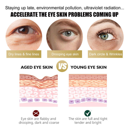 Retinol Eye Cream Stick Reduces Eye Bags, Dark Circles And Wrinkles, Moisturizes And Tightenes The Skin Around The Eyes