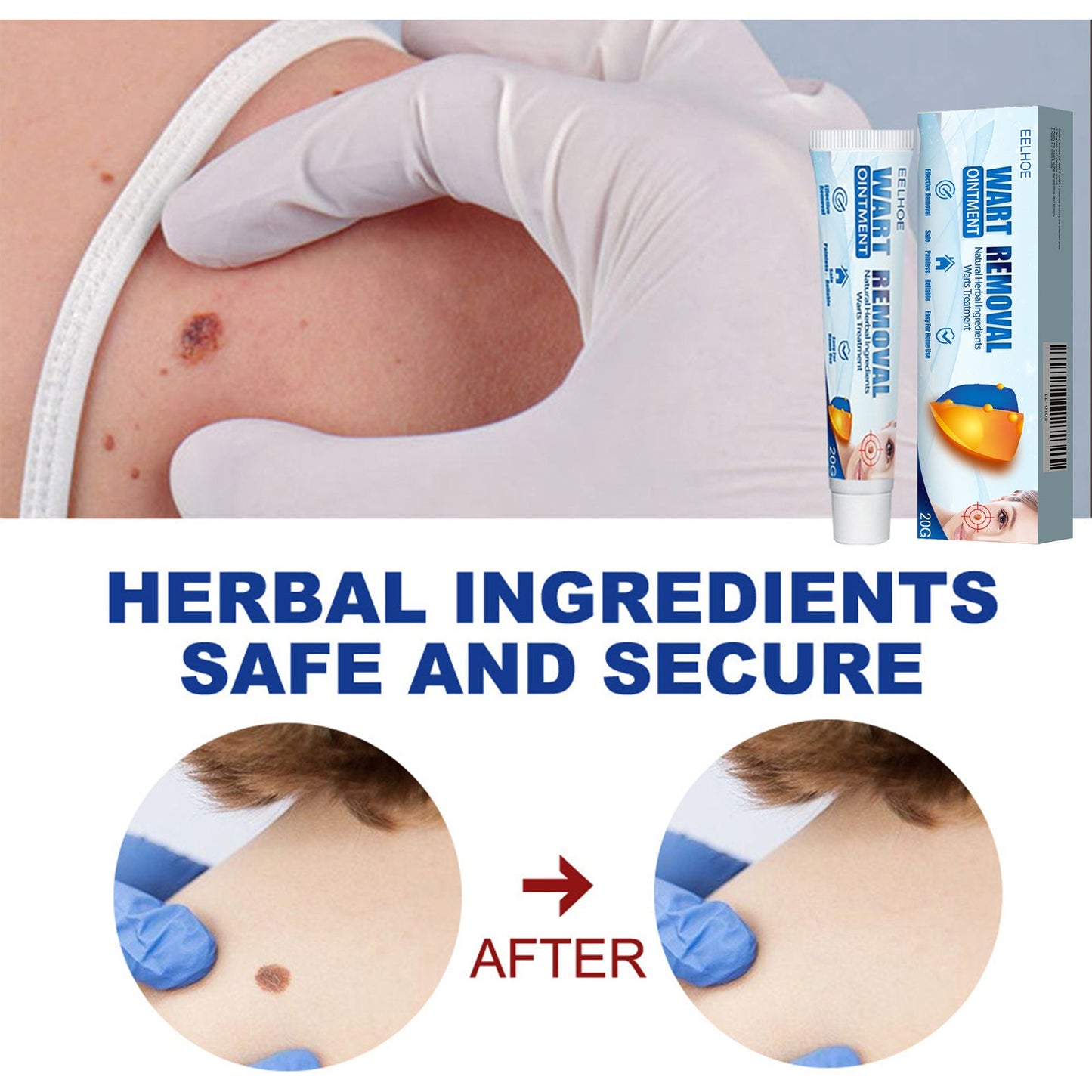 Keyu Cream Clean Skin Repair Care Body Face Remove Face Label Keyu Cream