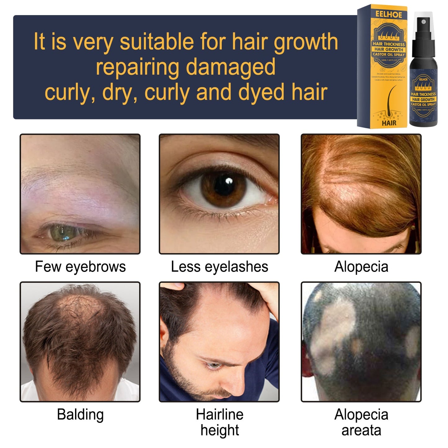Dense Castor Oil Nutrient Solution, Hair Prevention, Moisturizing Hair Follicles Massage Repair Hair Hair