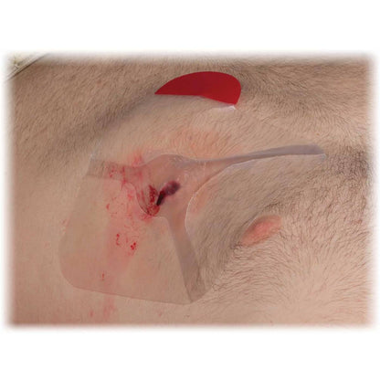 Hyfin Vent Chest Seal, 6" x 6", Twin Pack