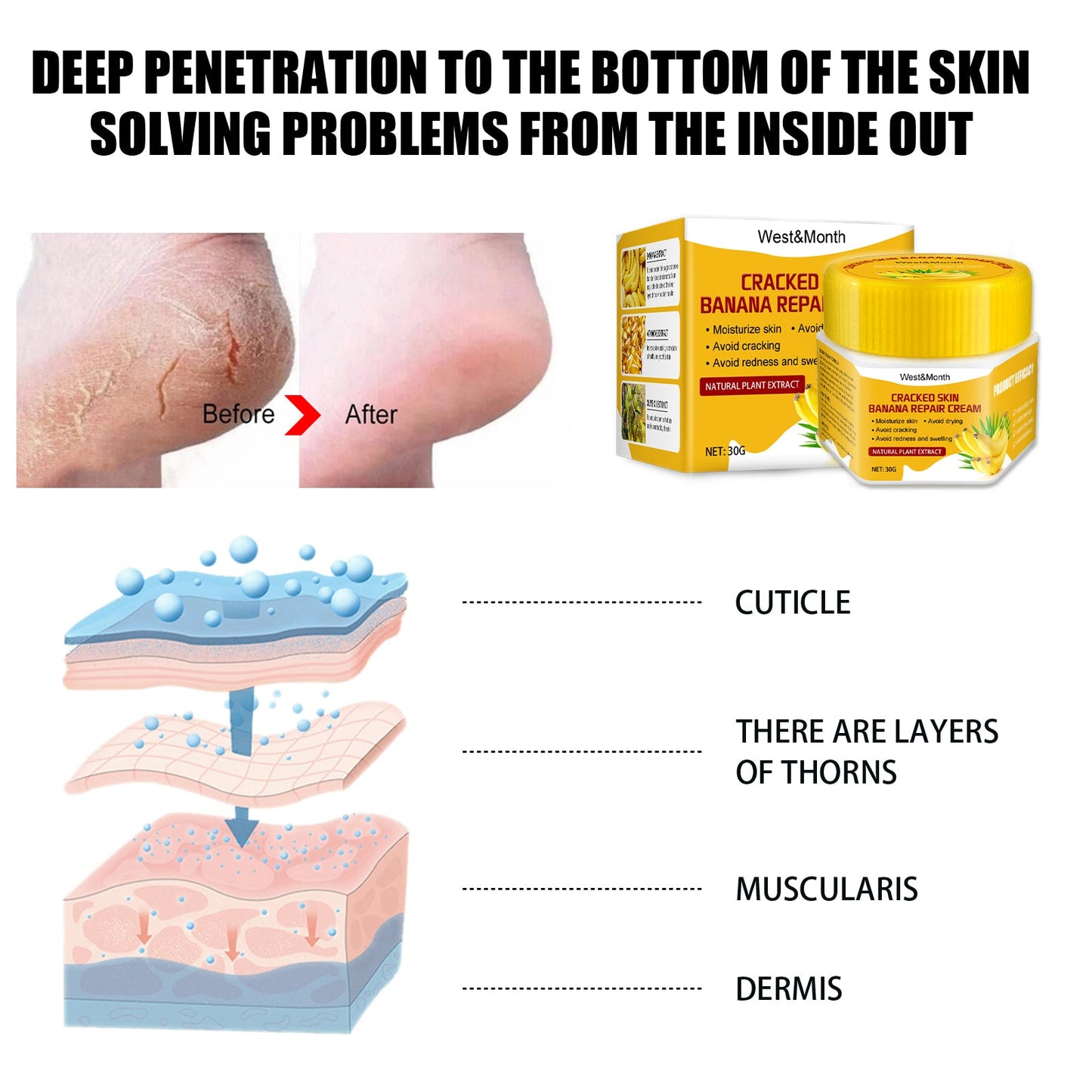Cracked Skin Banana Repair Cream, Nourishing And Moisturizing Foot Repair Cream To Soften Exfoliation And Remove Dead Skin Calluses