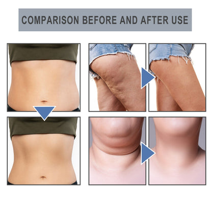 Slimming Essential Oil Nose Ring Tightens Curves And Reduces Belly Fat Shaping Essential Oil Ring Tightens Skin