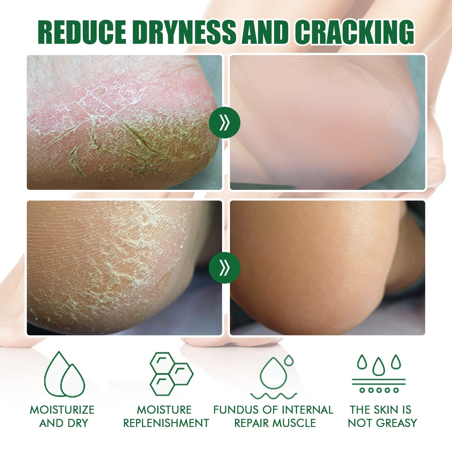 Chapped Heel Care Cream Repair Heel Peeling, Anti-Cracking And Moisturizing Foot Care Cream