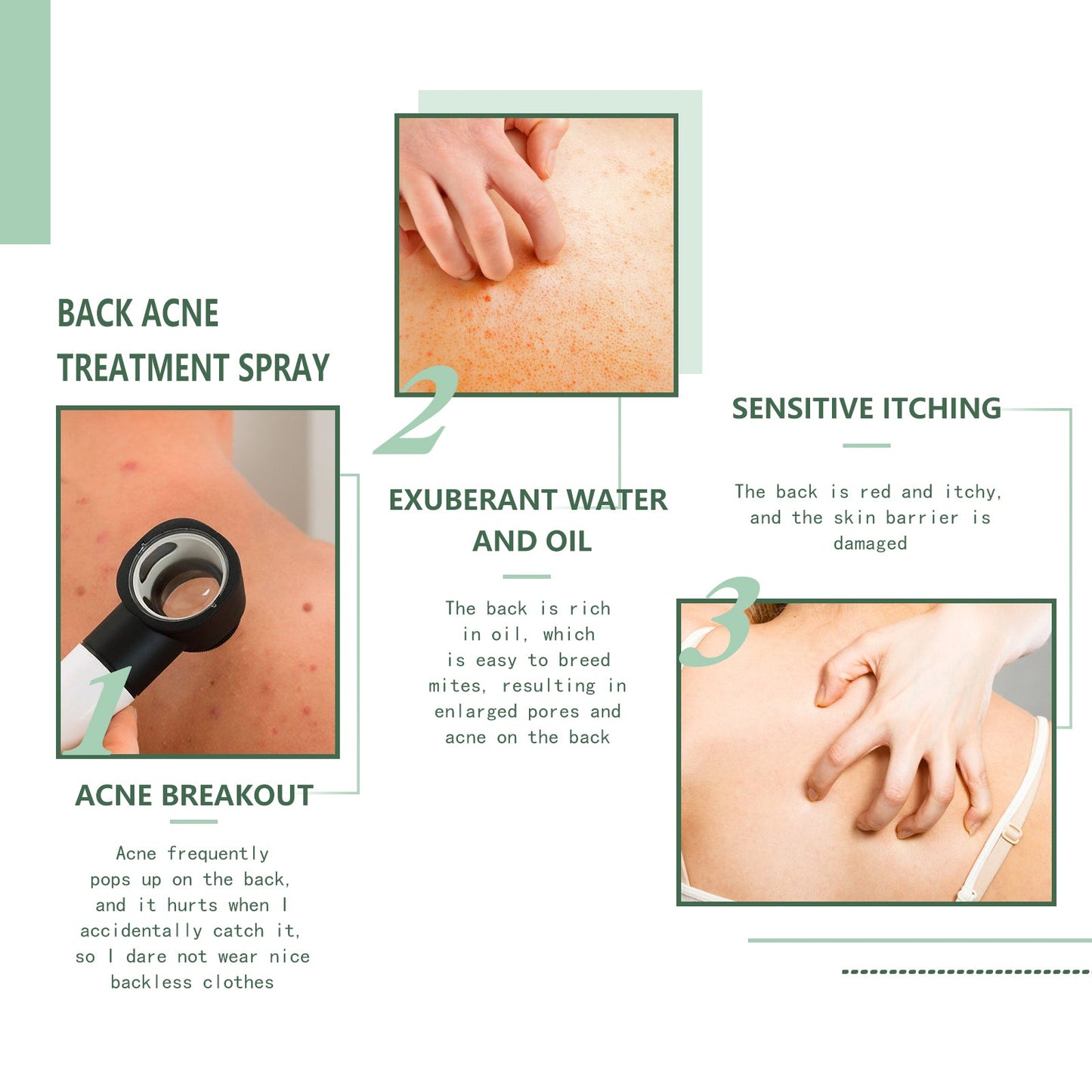 Body Acne Removal Cleanser Spray, Deep Clean Back Arm Fade Acne Beauty Moisturizing Spray