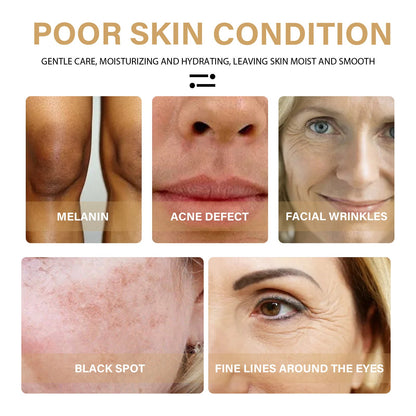 Turmeric Correction Essence Facial Care Hydrating Moisturizing Gentle Moisturizing Skin Care Essence