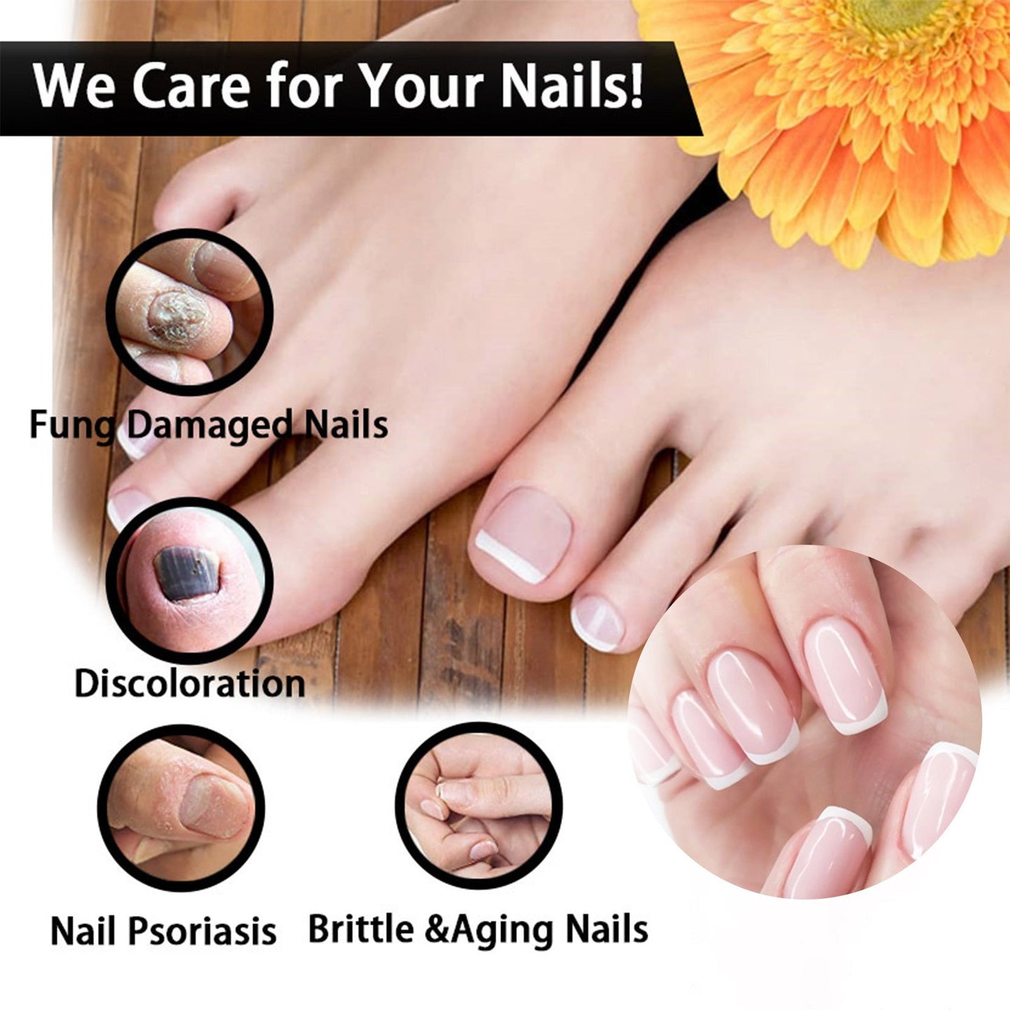Nail Repair Solution Thickening Brightening Nails Removing Gray Nails Dead Skin Repair Nourishing Nail Care Solution