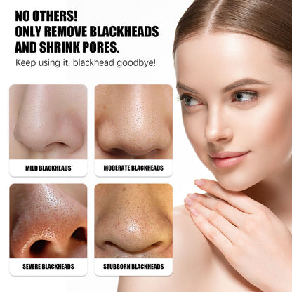 Remove Blackheads Peel Nose Mask, Deep Clean Remove Blackheads Acne And Tighten Pores Strawberry Nose Mask