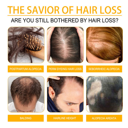 Biotin Hair Growth Spray, Strong Anti-Rip Repair Hair Care And Root Stabilization Spray