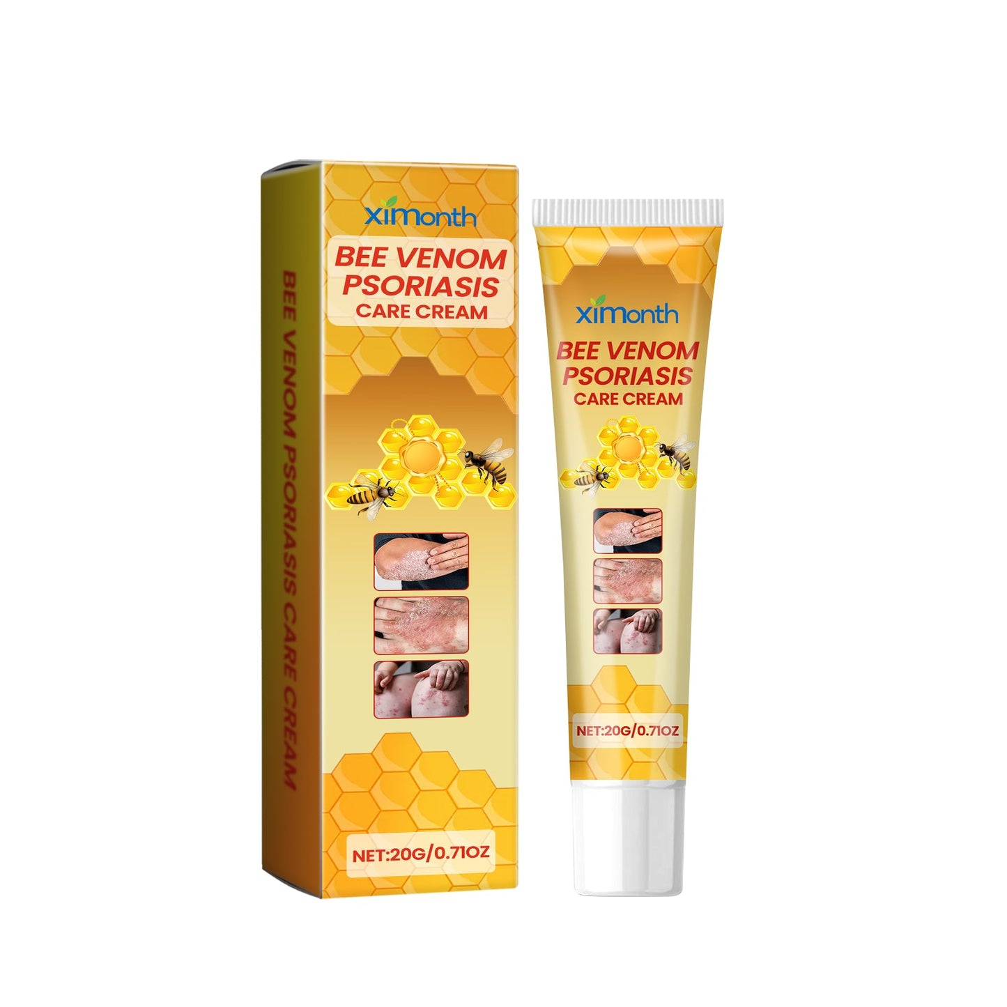 Bee-Poison Cowhide Moss Cream, Which Relieves Redness And Itchiness Of Skin