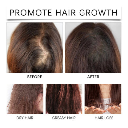 Palm Oil Hair Care Essence, Scalp Massage Treatment Repair Dry Hair, Soft And Solid Hair