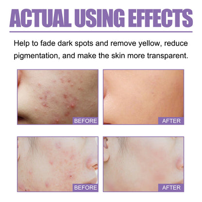 Lavender Oil Control Acne-Cleansing Soap For Cleansing Facial Skin Pores Oil Control Acne-Moisturizing Cleansing Soap