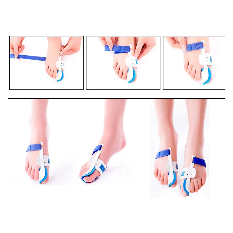 Bunion Device Hallux Valgus Orthopedic Braces Toe Correction Night Foot Corrector Thumb Goodnight Daily Big Bone Orthotics