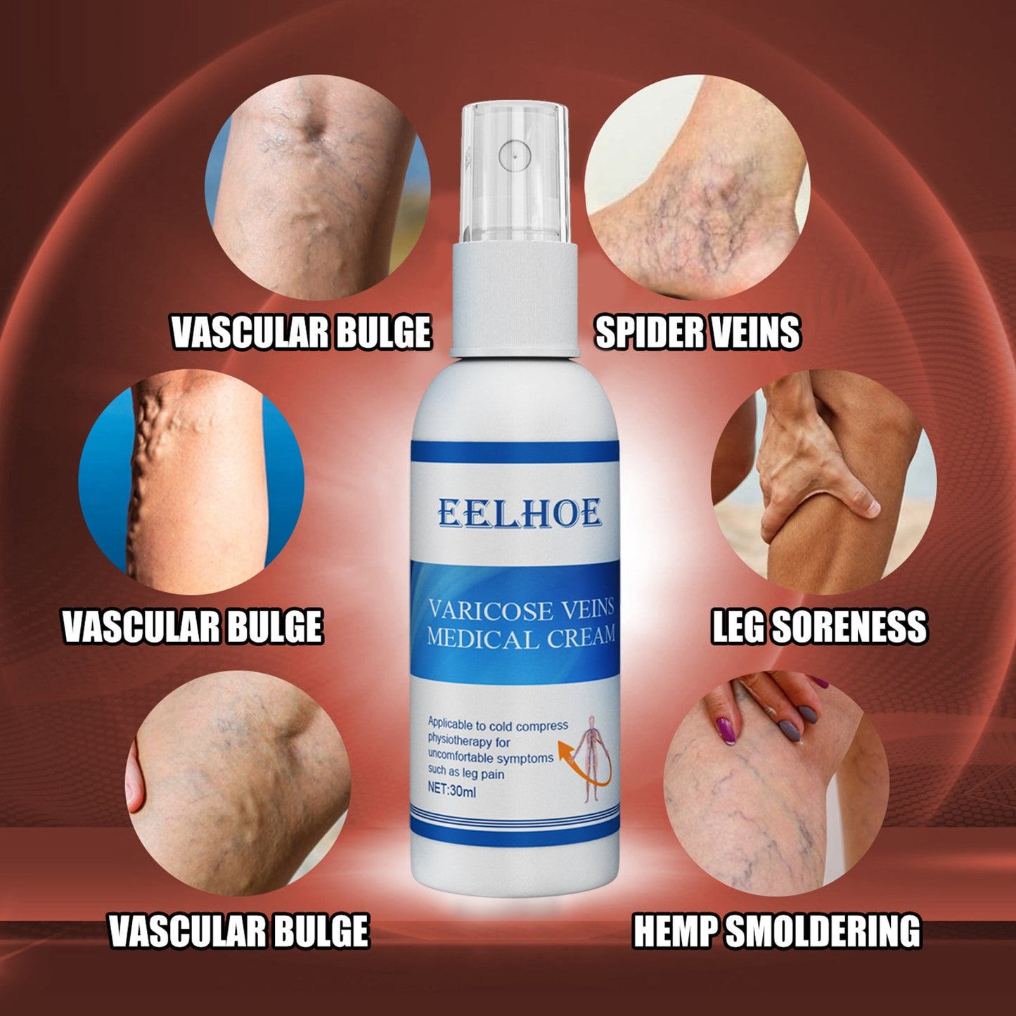 Intravenous Massage Spray For Varicose Veins Relief And Earthworm Leg Blood Vessel Bulge Pain Spray