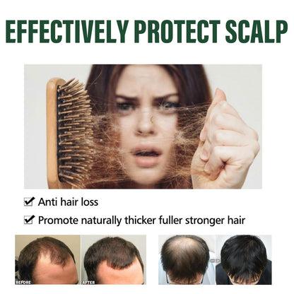 Amla Anti Hair Thinning Shampoo, Scalp Cleanness Moist Smooth Shiny Hair, Dense Hair Wash Protect Suits